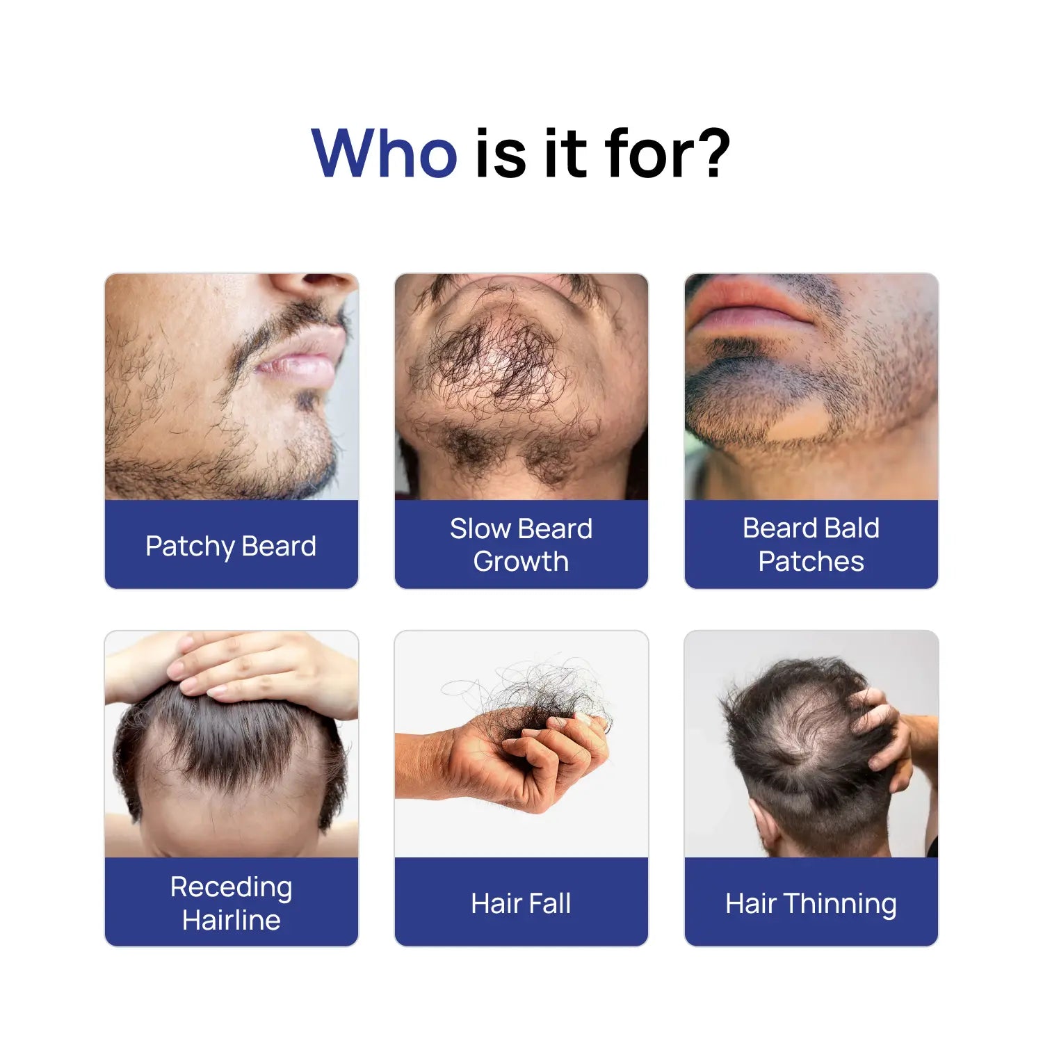 Beard Growth Super Kit — Minoxidil 5% + Derma Roller 0.5mm