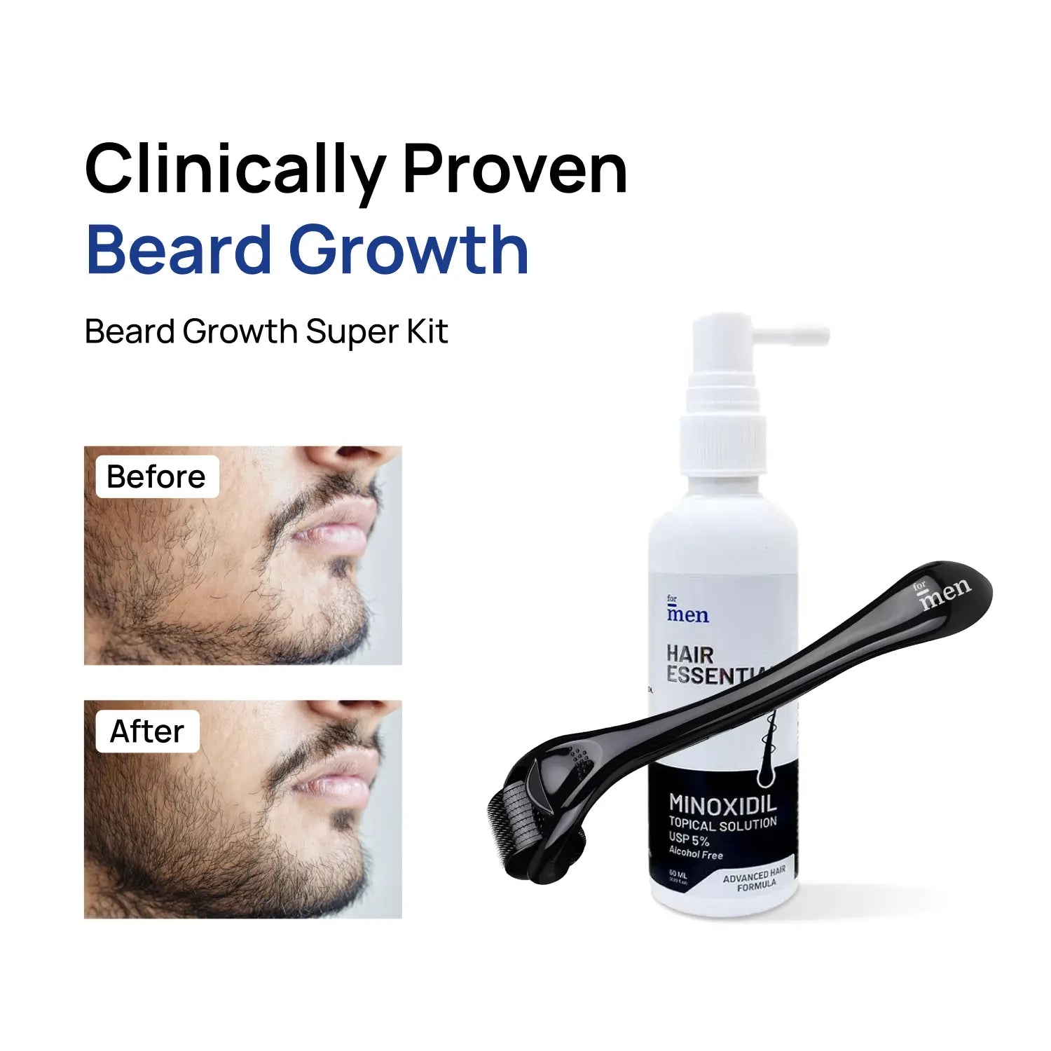 Beard Growth Super Kit — Minoxidil 5% + Derma Roller 0.5mm