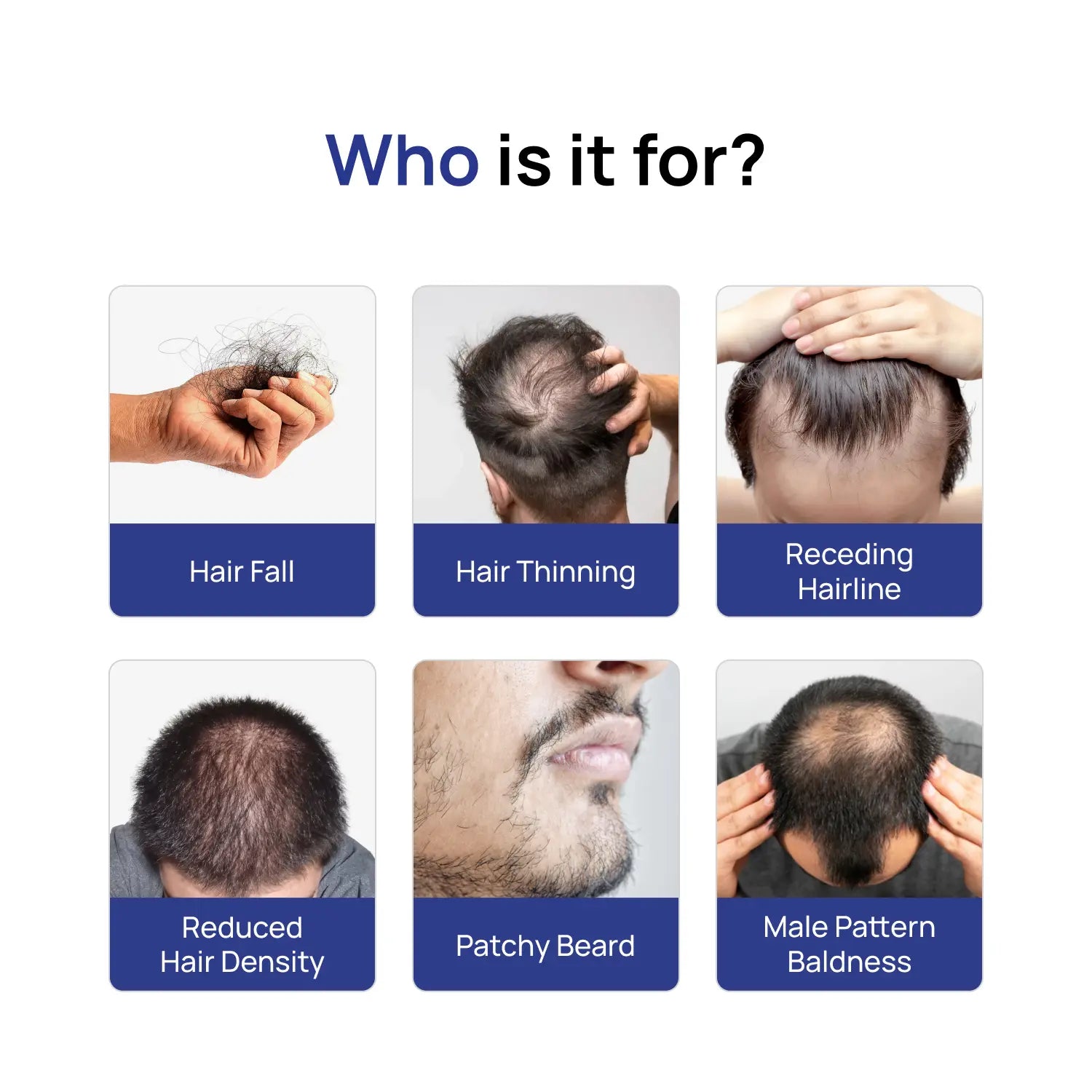 Hair Growth Super Kit — Minoxidil 5% + Derma Roller 1mm