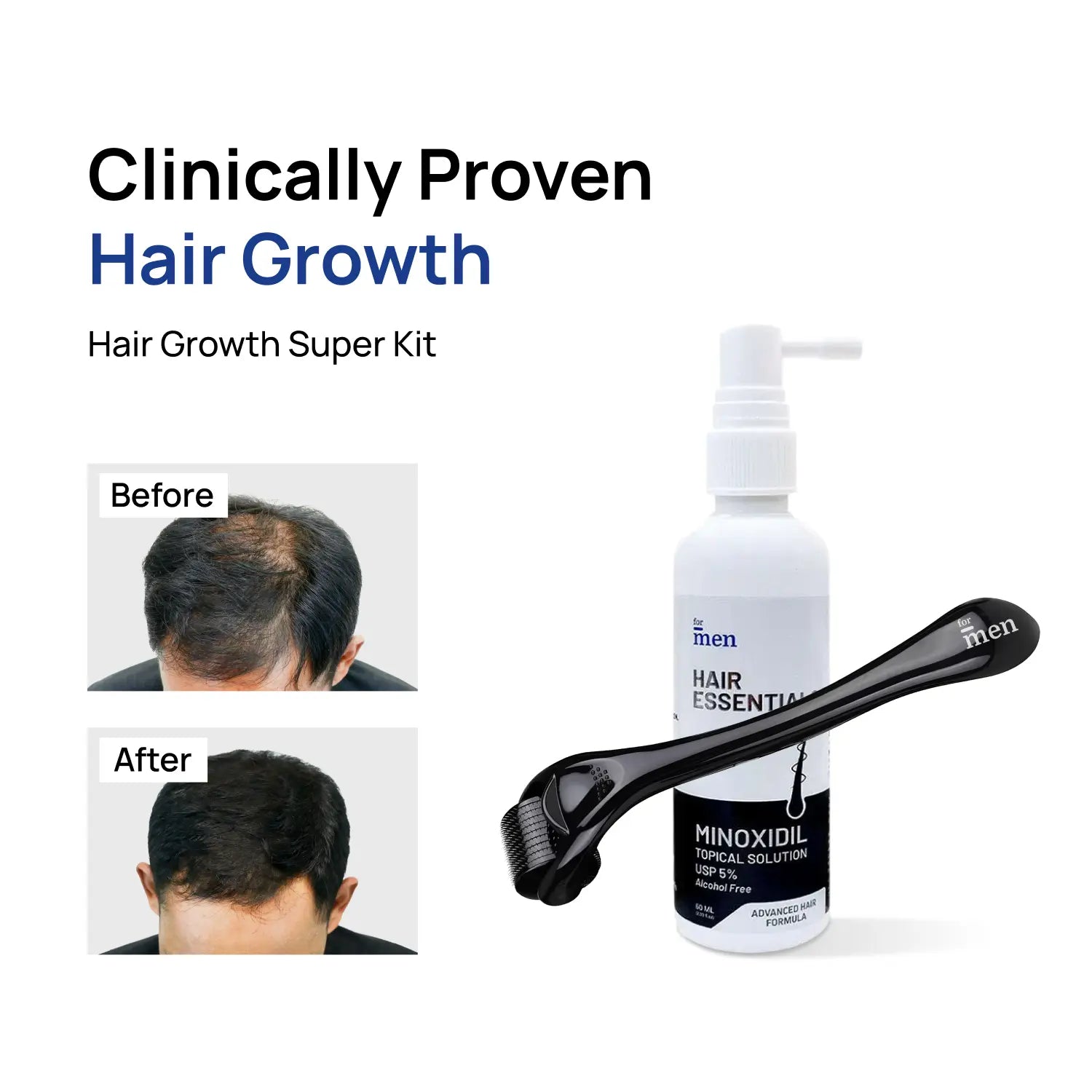 Hair Growth Super Kit — Minoxidil 5% + Derma Roller 1mm