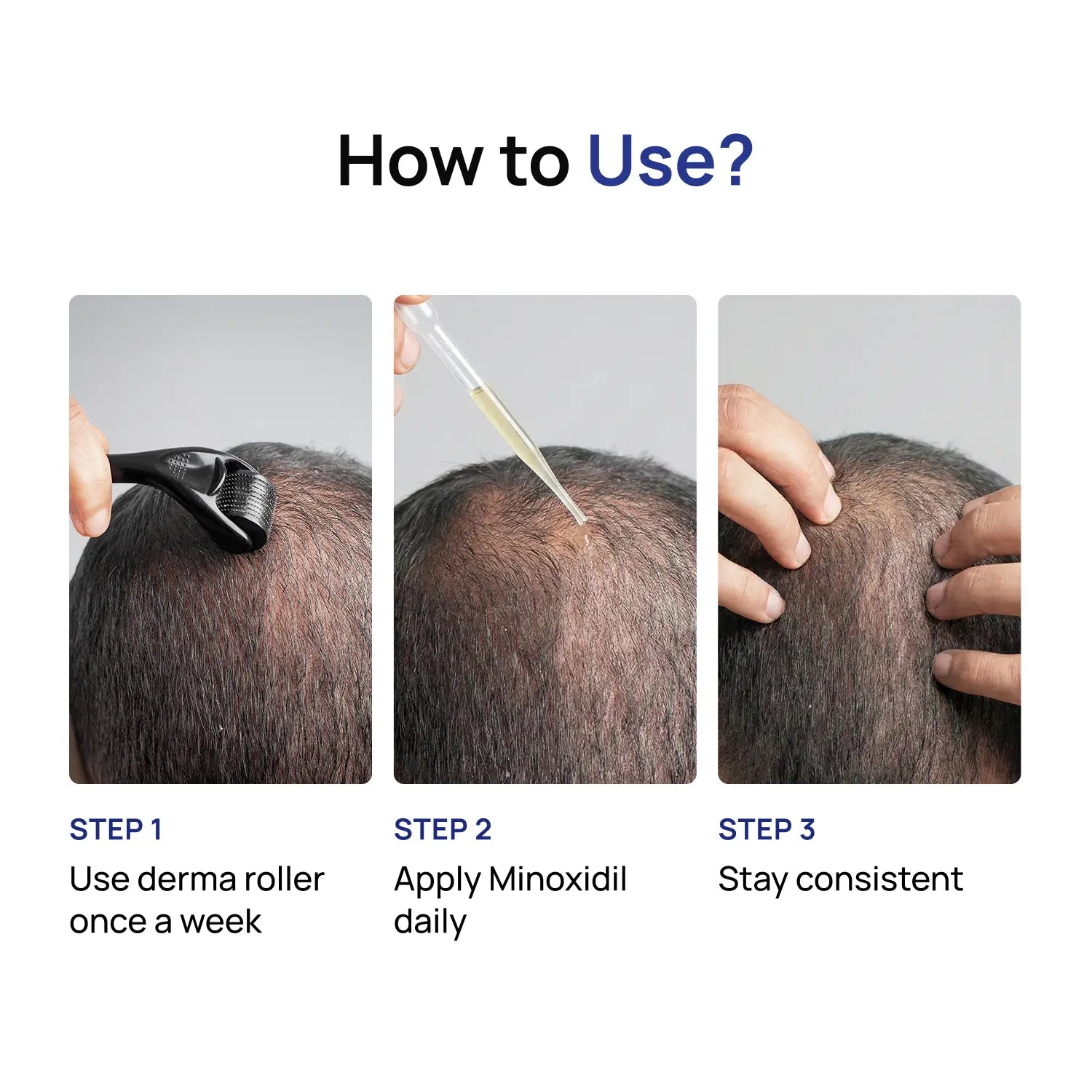Hair Growth Super Kit — Minoxidil 5% + Derma Roller 1mm